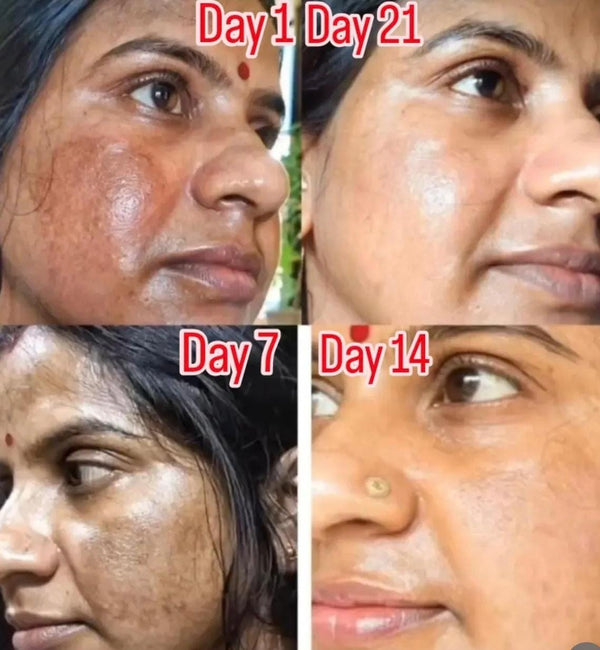 Customer before and after result
