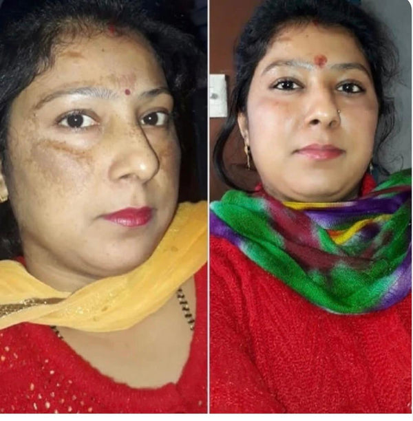 Customer before and after result