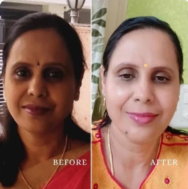 Customer before and after result