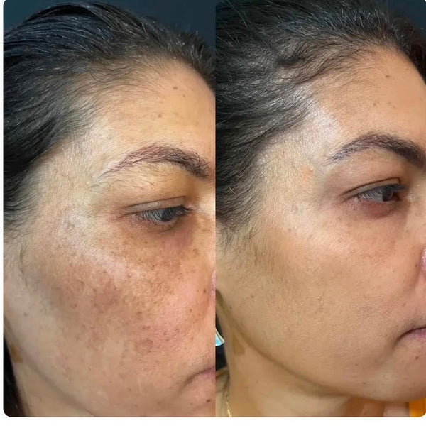 Customer before and after result
