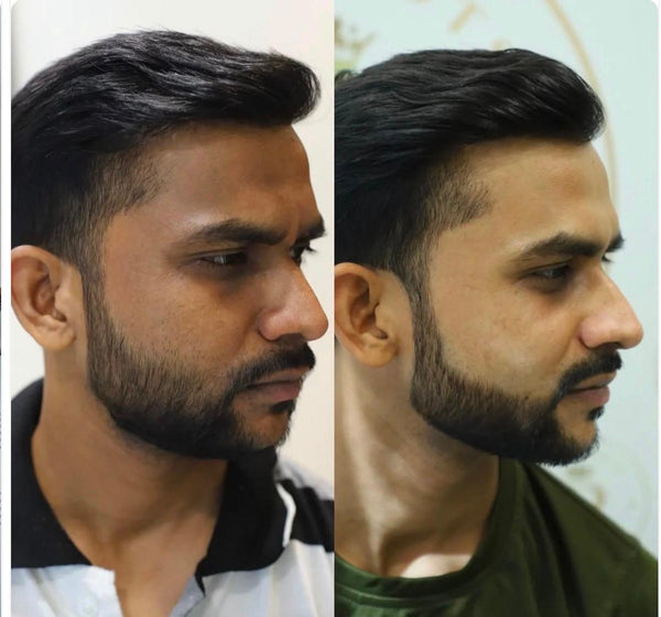 Customer before and after result