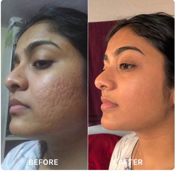 Customer before and after result