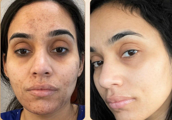 Customer before and after result