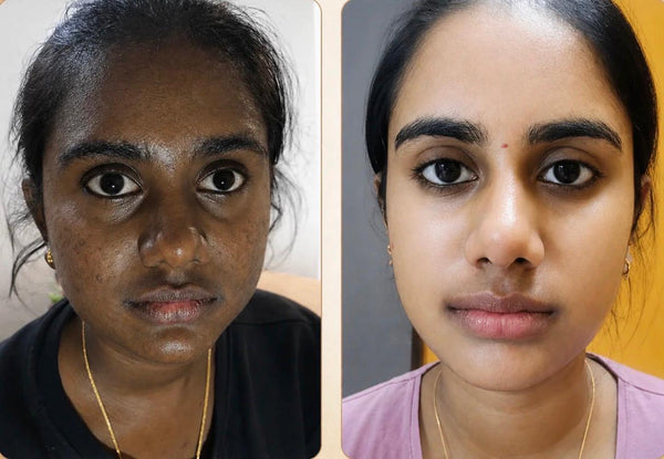 Customer before and after result